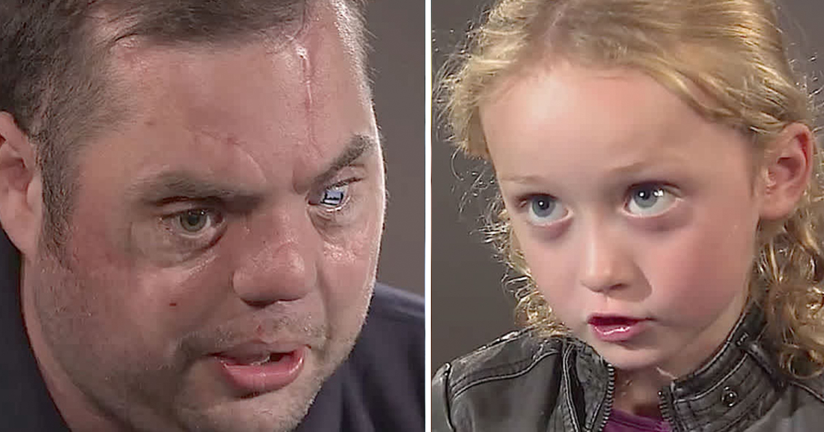 Disfigured war veteran comes face-to-face with 5-year-old girl – her reaction to his scars is heartbreaking - Latest news!