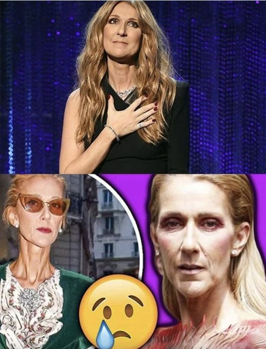 Celine Dion condition continues to deteriorate she cancels her entire